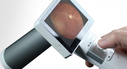 Thiết bị chụp ảnh đáy mắt Fundus Camera