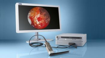 Bộ dụng cụ phẫu thuật nội soi lồng ngực